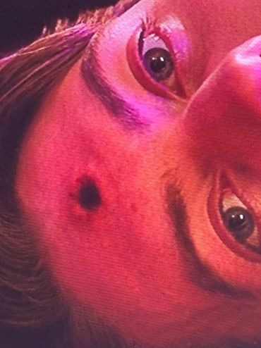 Close-up of a person's face with a dark mark on the forehead under red lighting.