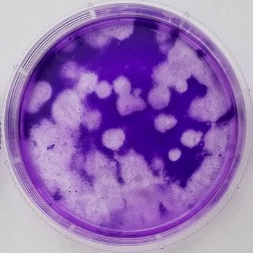 Three petri dishes with purple agar showing different bacterial growth patterns.
