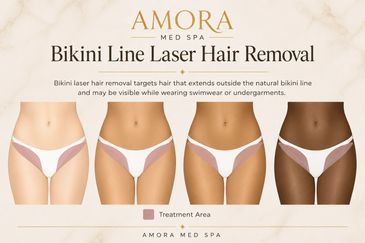 Four women showing bikini line laser hair removal treatment areas.