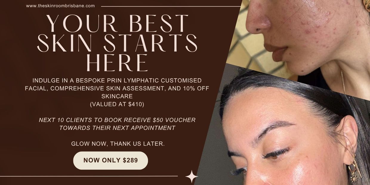 Before and after skin treatment images promoting a customized facial offer at a discounted price.