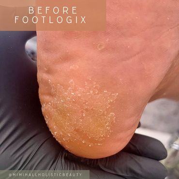 Before and after picture of a footlogix pedicure at my nail salon in Newport Pagnell 