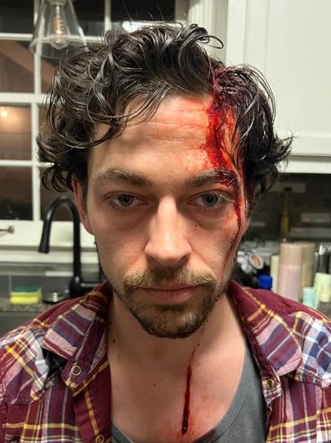 Blunt Force Head Trauma Makeup