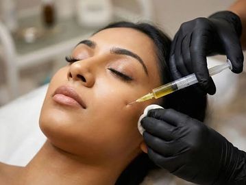 PRP mesotherapy treatment for skin rejuvenation and collagen stimulation in Havant.