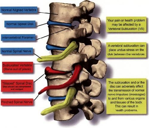 Cracking The Code: How Chiropractors Can Relieve Tailbone Pain