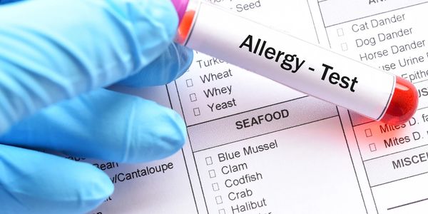 Image of a gloved hand holding a vial stating "Allergy Test"