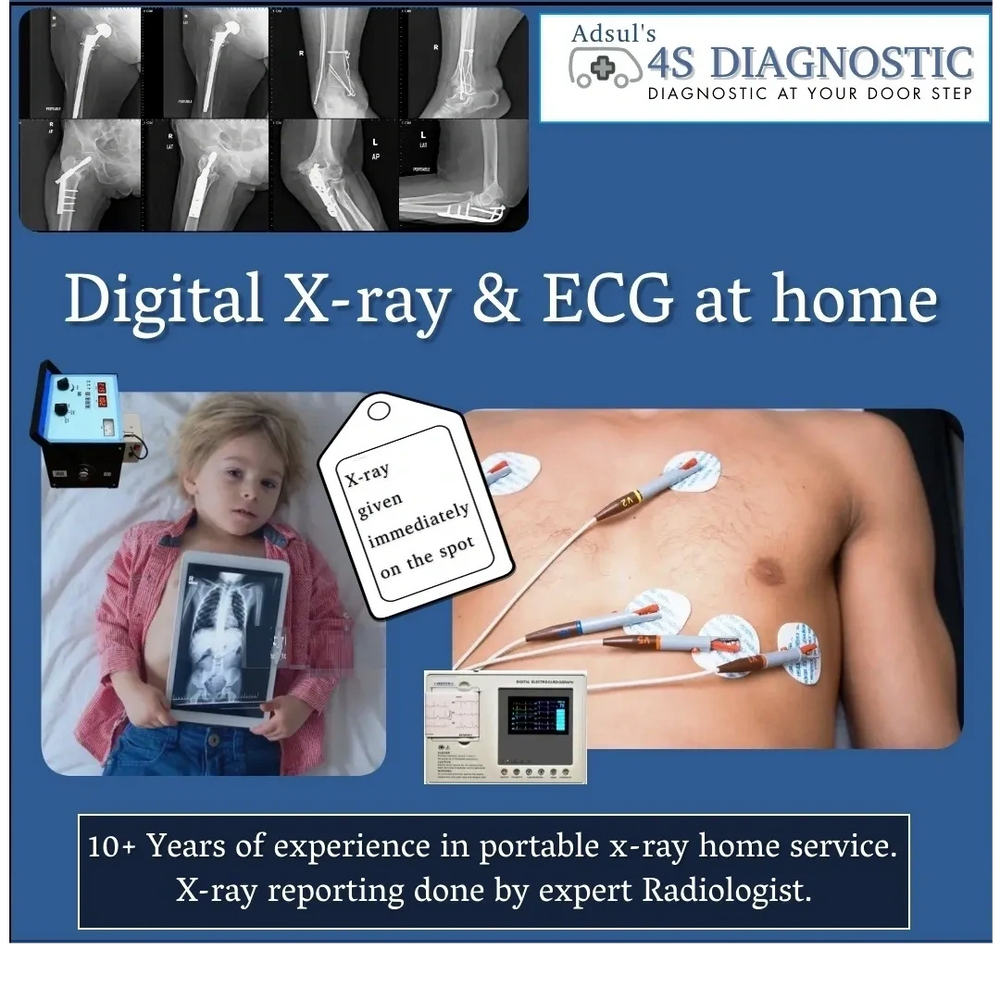 Portable Digital XRay at Home Service Near Me in Pune PCMC ECG Home