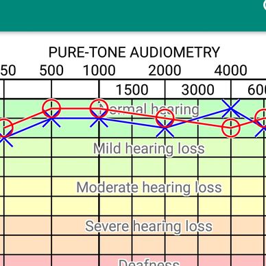 Hearing Test - Pure-tone audiometry on Android