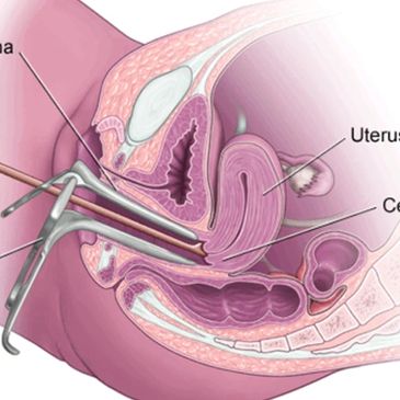 Annual Exam and PAP Smear with HPV Test