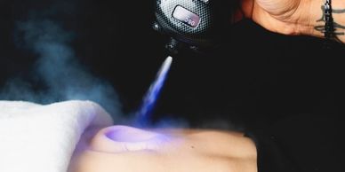 A person receiving cryotherapy with a device emitting cold vapor.