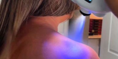 Close-up of a woman's shoulder under UV light showing skin detail.