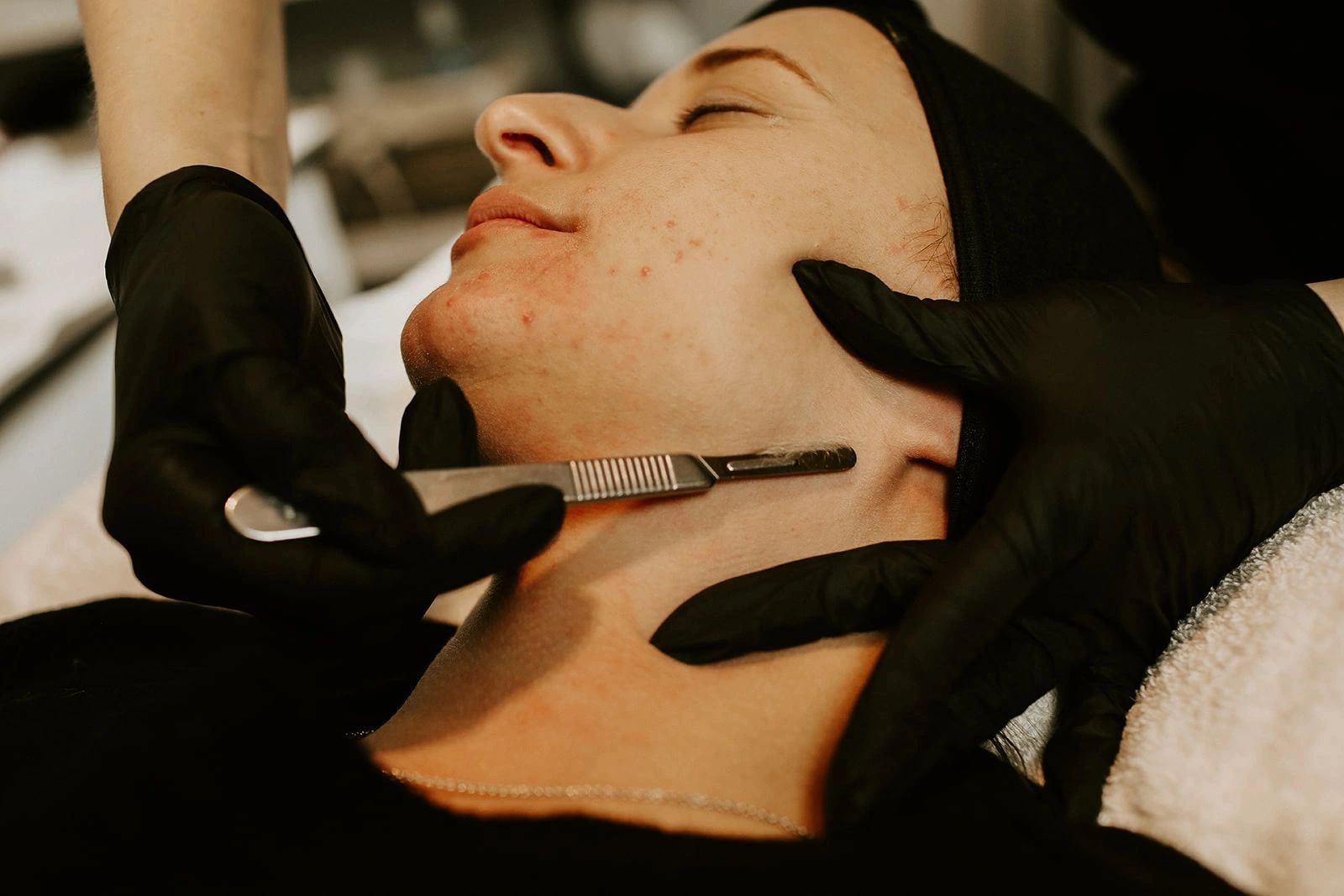 Dermaplaning away dead skin cells and vellus hair.