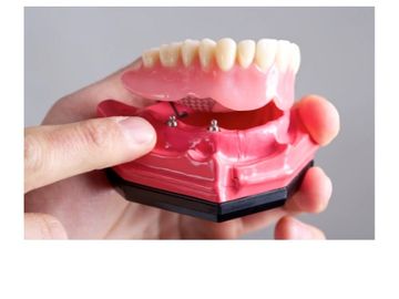 Implant denture 