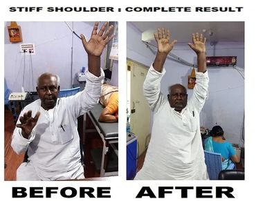 Frozen  Shoulder - Complete Result