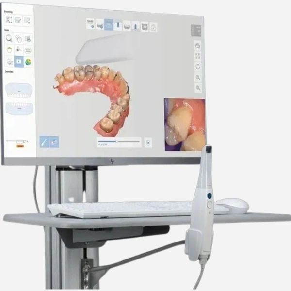 The latest most advanced Dental Digital Scans