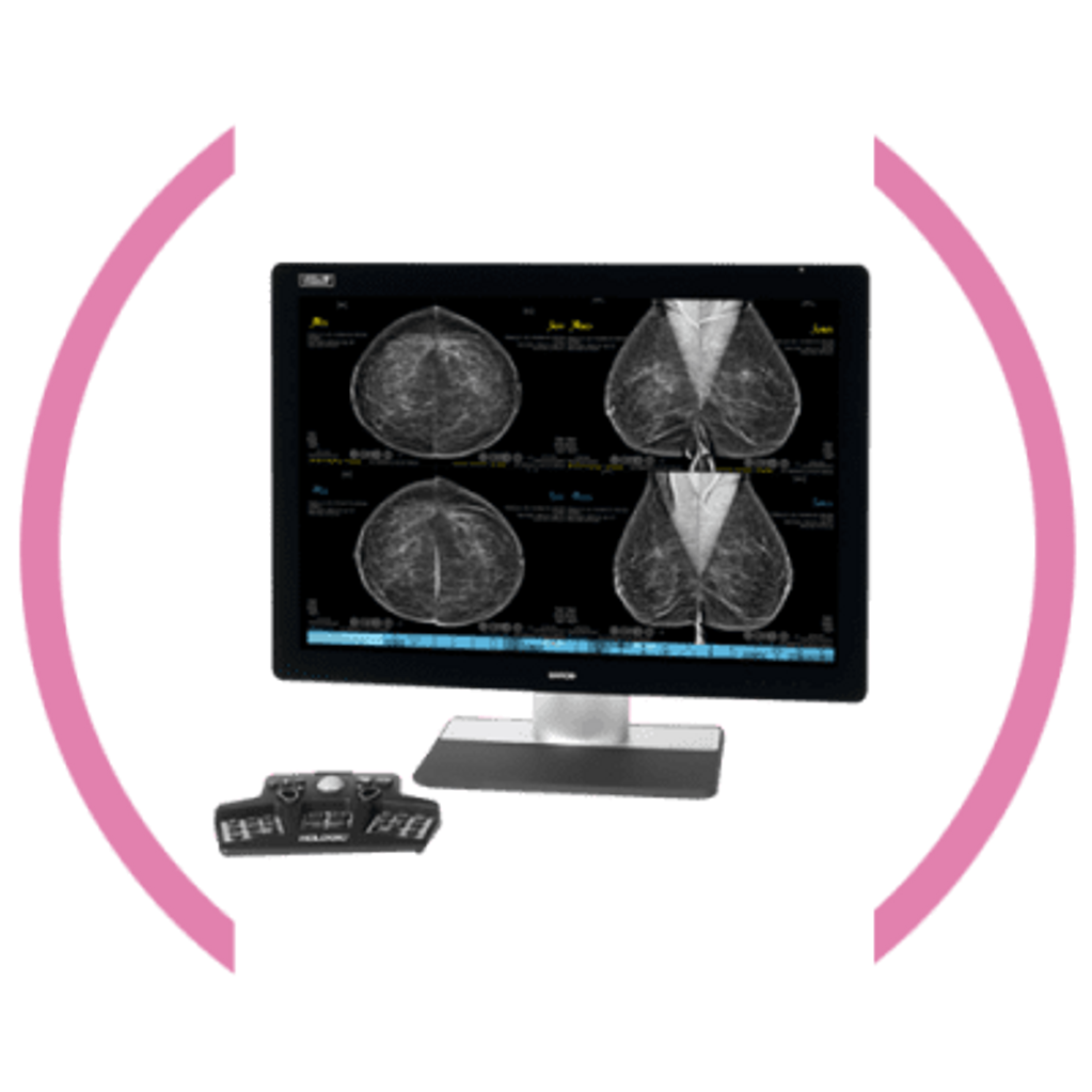 Hologic Selenia Radiologist Workstation