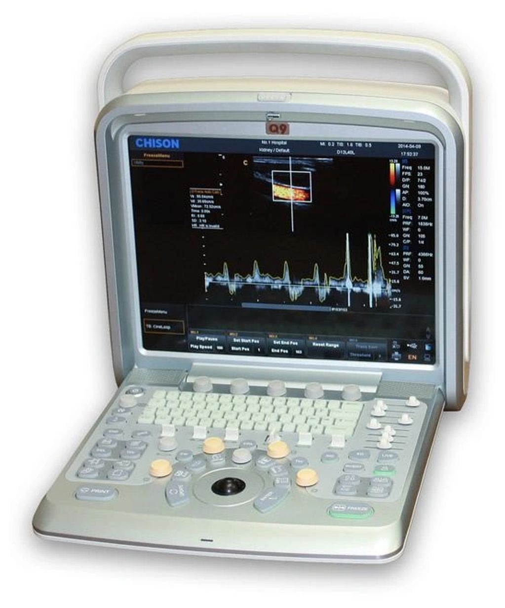 Chison Q9VET Ultrasound