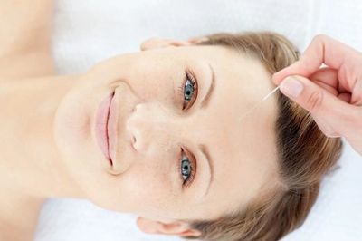 Closeup shot of women getting a Acupuncture
