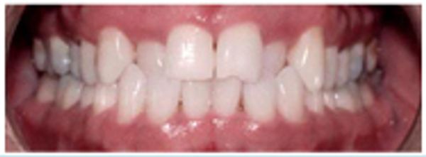 Before treatment 