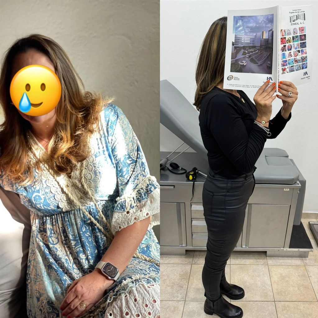 PACIENTE DE 56 AÑOS, CON MENOPAUSIA E INCREMENTO DE PESO. Perdio grasa, incrementó músculo..