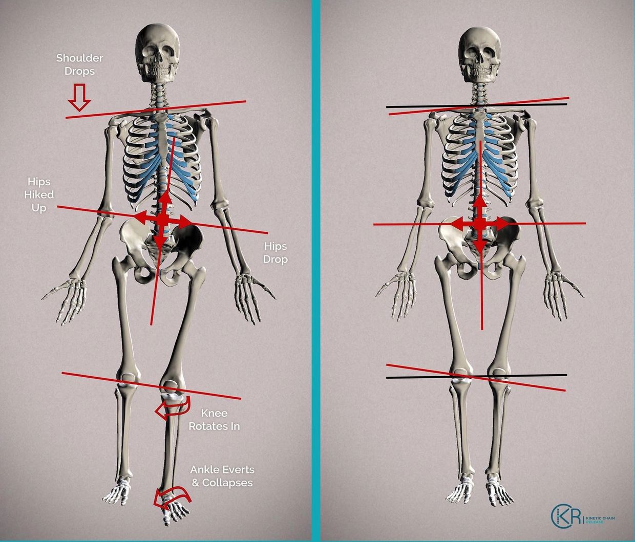 Kinetic chain release (KCR)