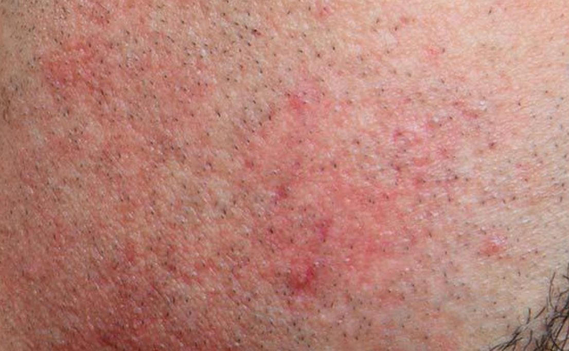 This Is Why Your Skin Reacts