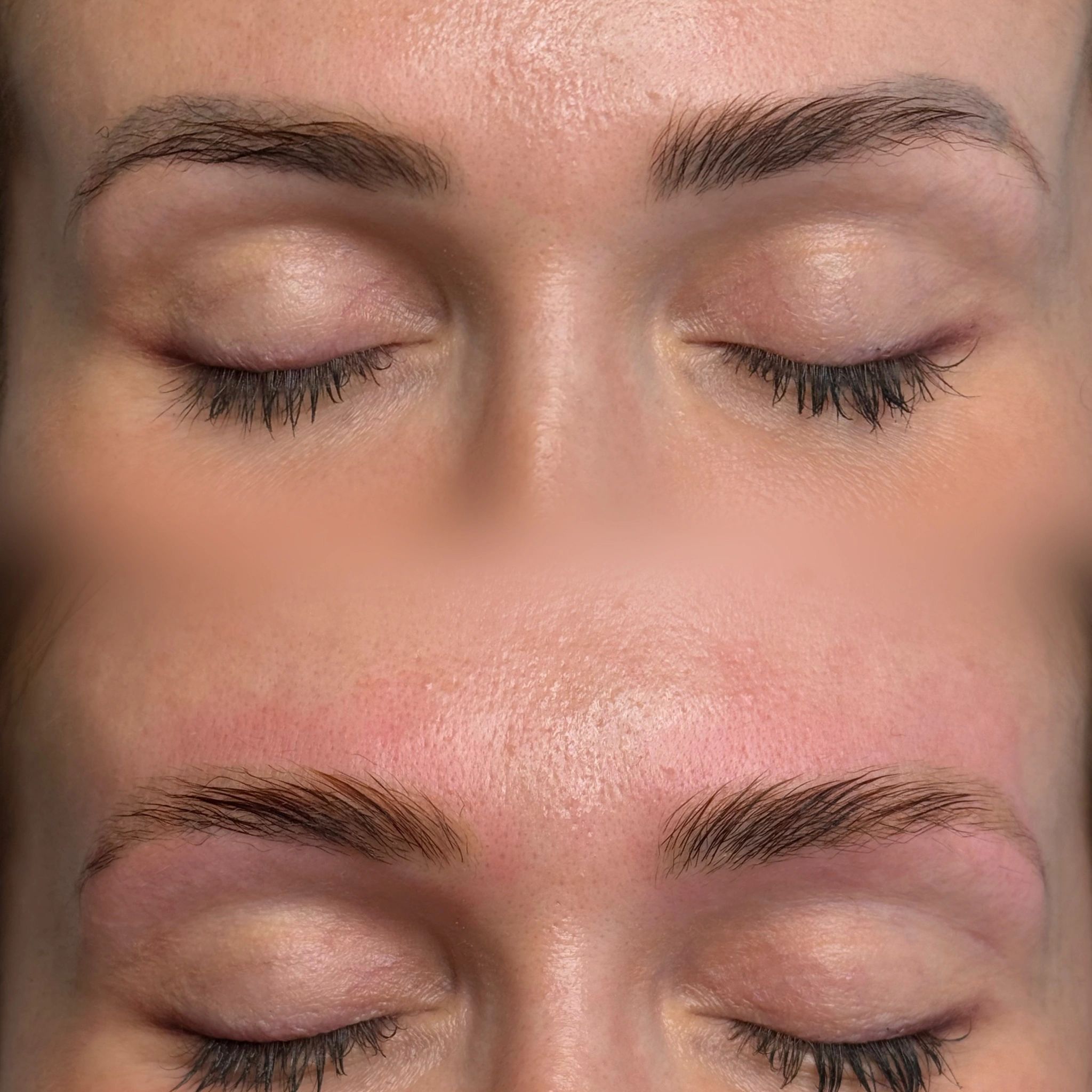 laser eyebrow tattoo removal