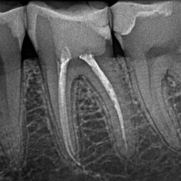 Dr.Sandra Shambarger, Endodontics, Texarkana Endodontics, Texarkana, Root Canals, Endodontist