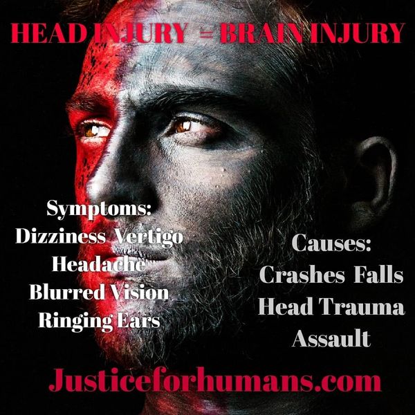 head trauma from California car accident