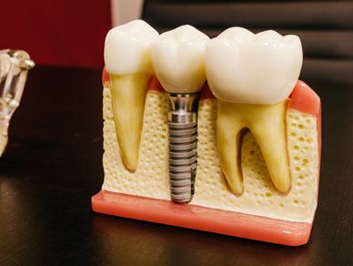 Tooth Emergency Watertown Dentist