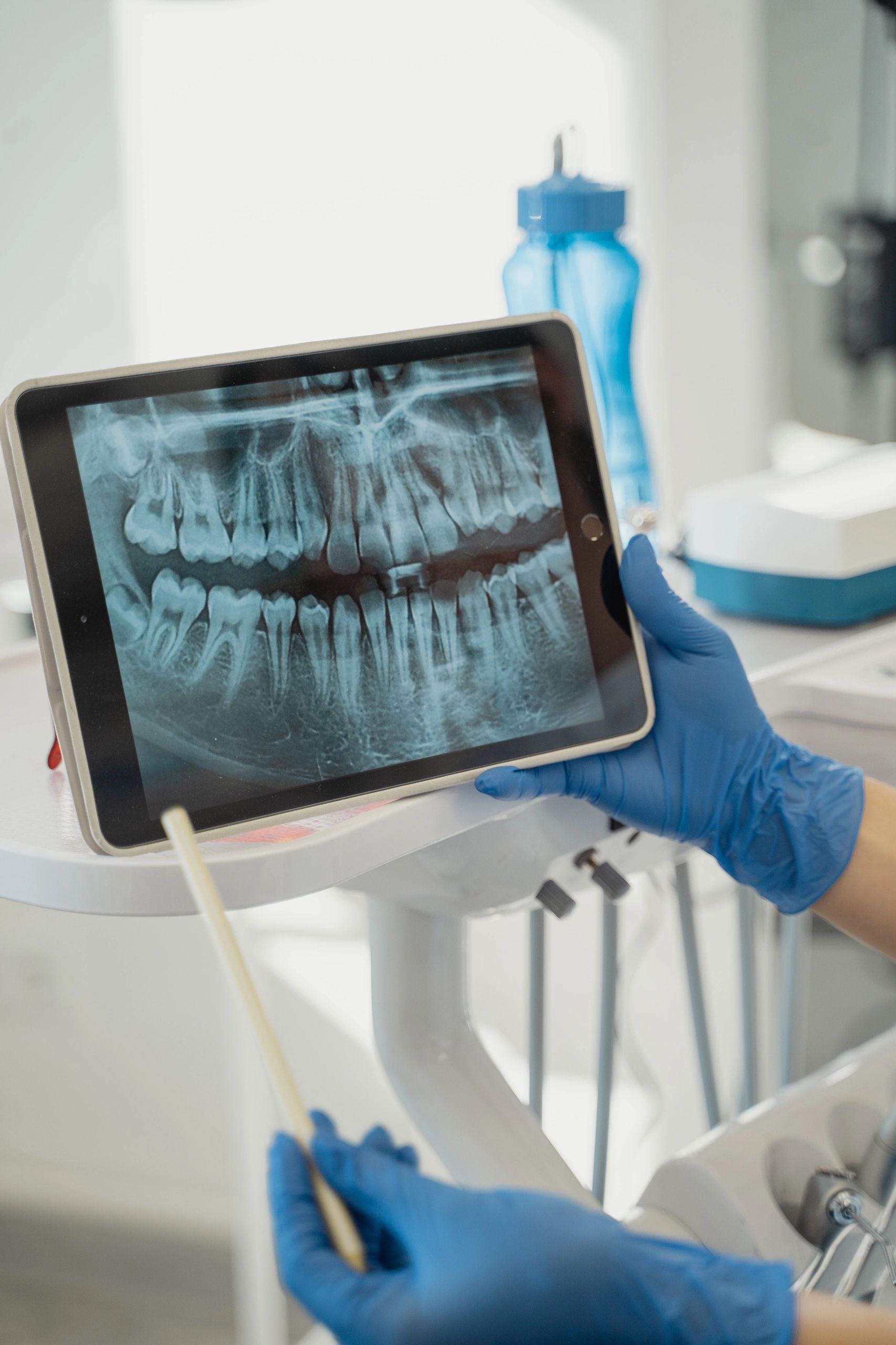 Wisdom Teeth & Extractions in Watertown, SD at Dynamic Dental