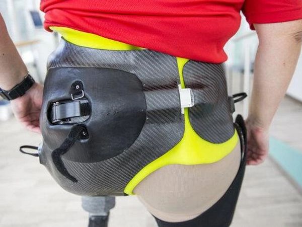 Close-up of a modern prosthetic hip socket attached to a person's body.