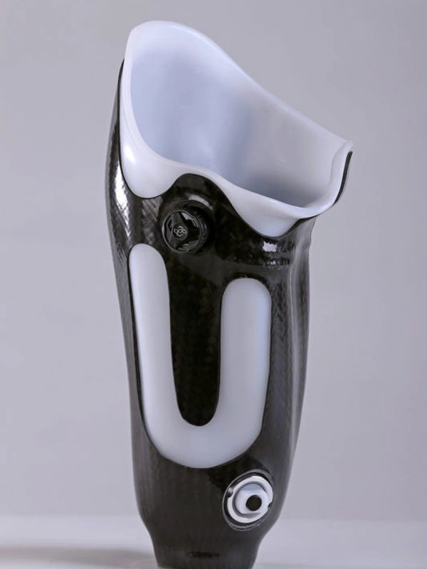 A modern prosthetic leg socket with a carbon fiber exterior and white inner lining.