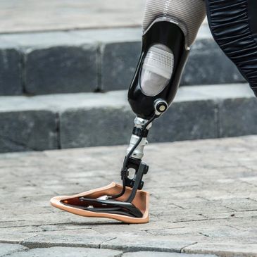Close-up of a prosthetic leg with a specialized foot on cobblestone pavement. Ossur