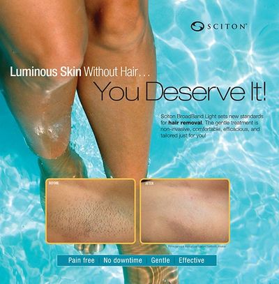 Laser Hair Removal Laser Hair Removal