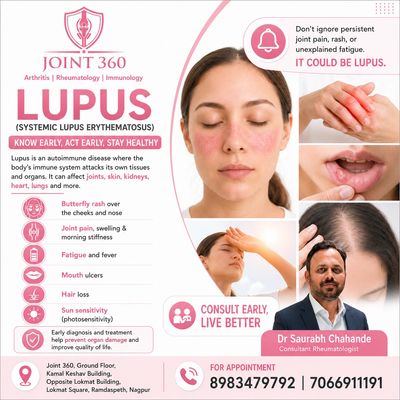 Informative lupus awareness poster by Joint 360.