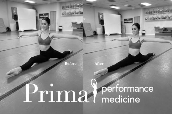 Split work- Before and After