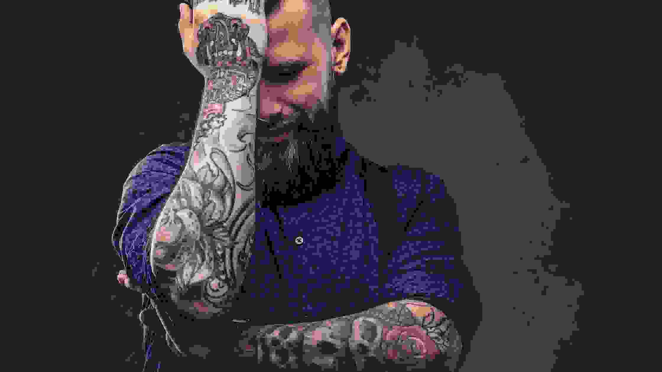 Laser Tattoo Removal | Tattoo Bill's, Inc.