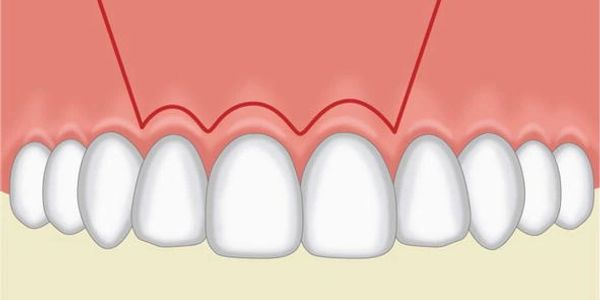 gum surgery faridabad
best gums specialist
periodontist faridabad
laser gum surgery faridabad
