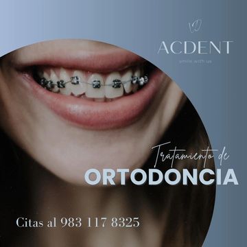 ACDENT es una clínica dental recomendable por su profesionalismo y atención.
Calle 28 esquina Av 3