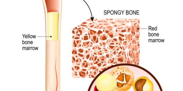 Diagram showing yellow and red bone marrow in spongy bone.