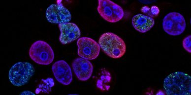 Supporting Medical Investigation, Particularly Lung Disease Research