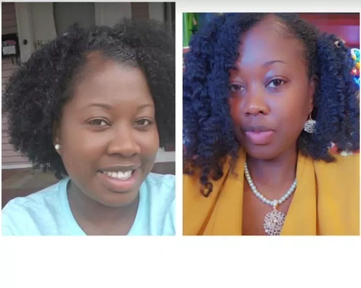 A before and after image of a woman with a hairline problem