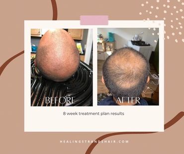 Results. Results. No injections. No romaine. No transplant.