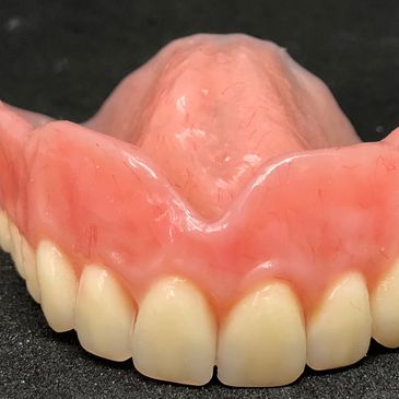 dentures