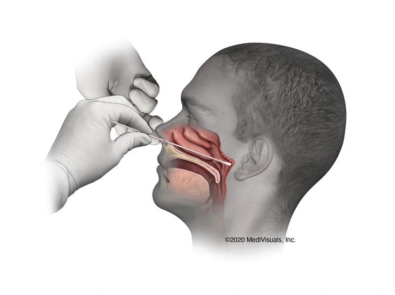 How a Covid-19 swab test is conducted