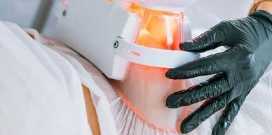 Patient receiving cryolipolysis fat freezing treatment for body contouring at Royal Derma Clinic.