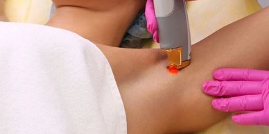 Woman receiving laser hair removal treatment for smooth, hair-free skin at Royal Derma Clinic.