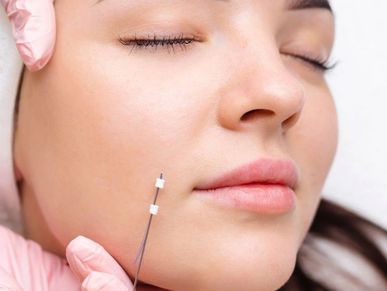 Patient need Threads thread lift for non-surgical facelift and skin tightening at Royal Derma Clinic
