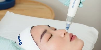 Patient receiving mesotherapy injections for skin rejuvenation and hydration at Royal Derma Clinic.