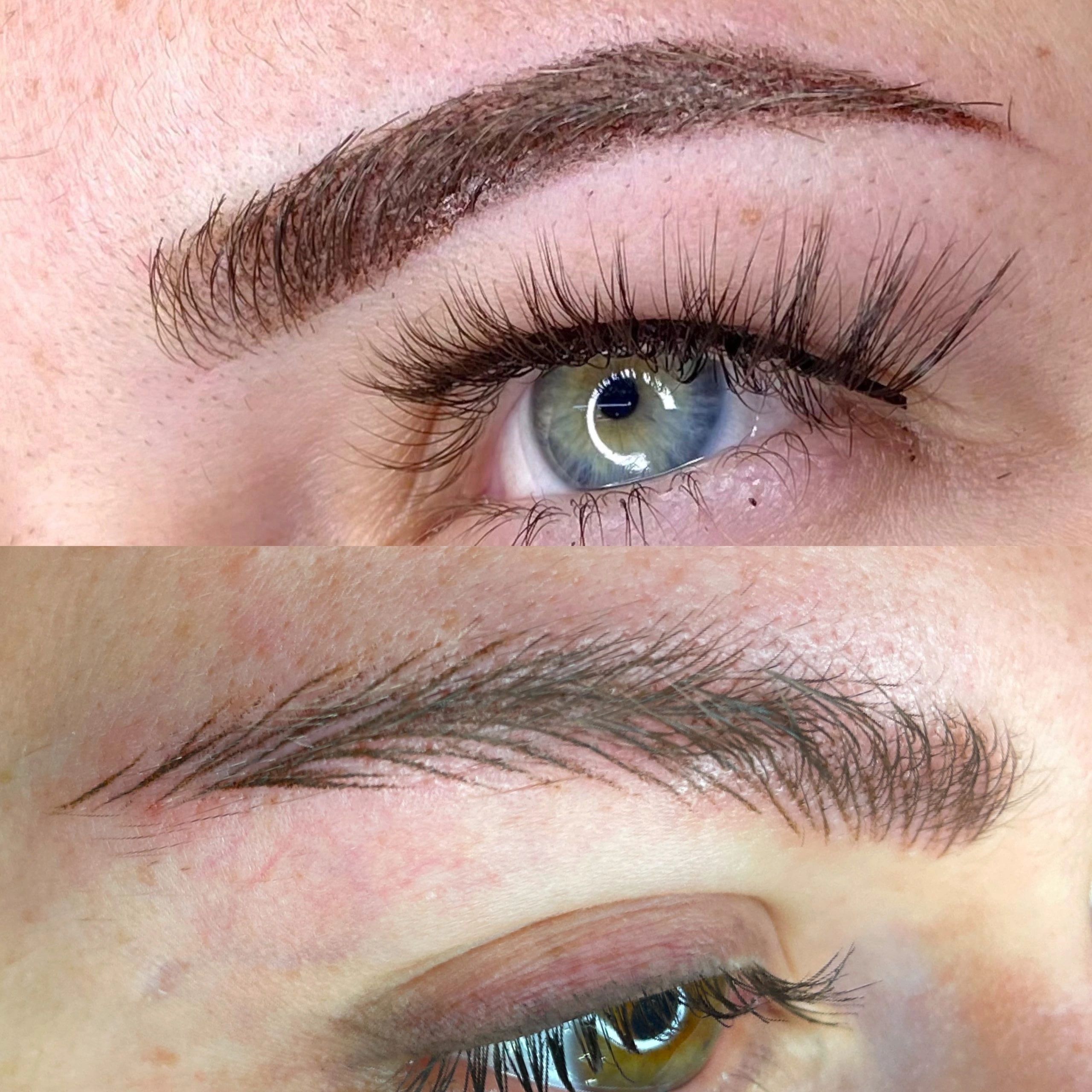 Eyebrow Aesthetics